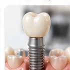 Implant and periodontics