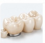 Prosthodontics
